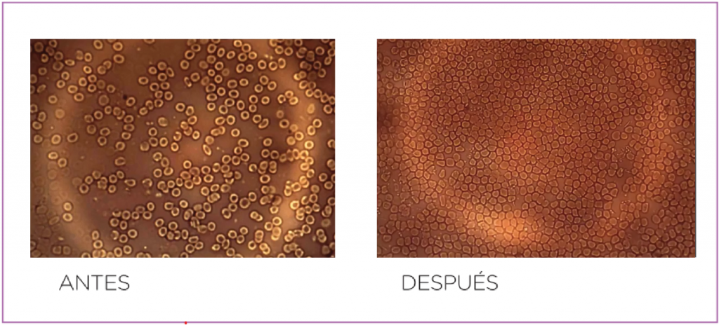 sangre en vacunas antes y despues